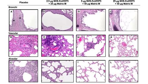 Representative Histopathology Of Lungs From Nvx Cov Vaccinated