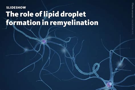 Lipid Metabolism Impacts Remyelination Lipotype Gmbh