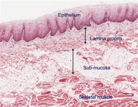 DEN104 Oral Mucosa Flashcards Quizlet