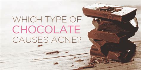 Why Does Chocolate Cause Acne Letsdiskuss