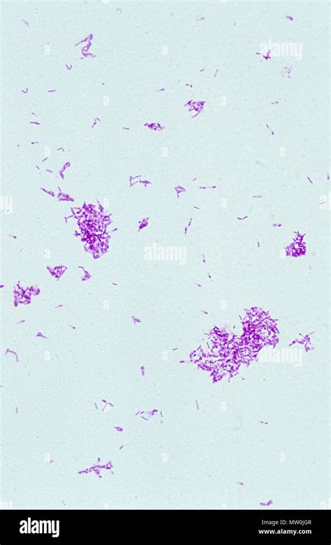 Clostridium Tetani Gram