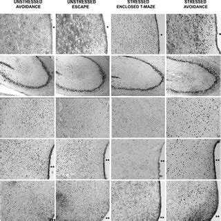 Photomicrographs Of Fos Immunoreactive Cells Dark Spots In Coronal