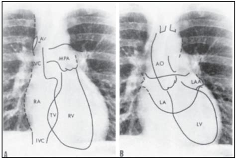 CV201 Cardiovascular Imaging Flashcards Quizlet