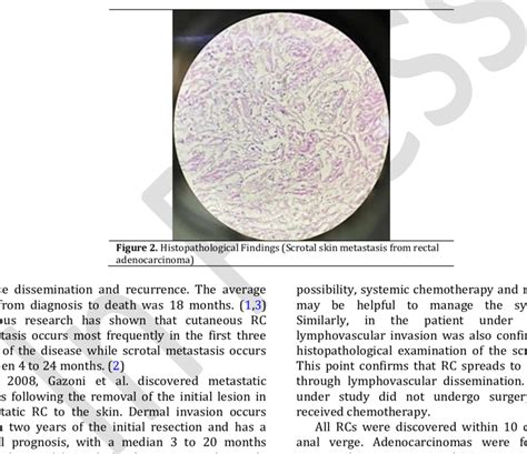 Scrotal Lesions Before And After Chemotherapy Download Scientific