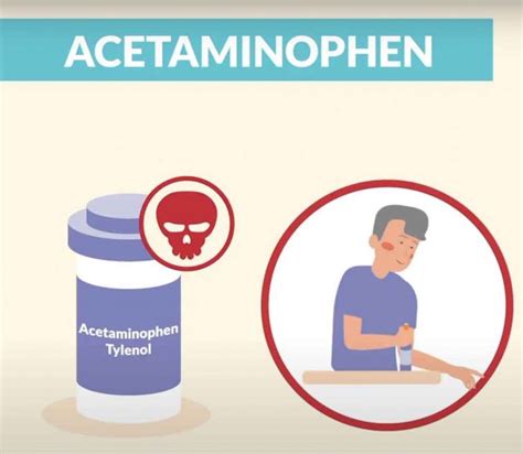 Acetaminophen Vs NSAIDs Ibuprofen Dosage Side Effects Overdose