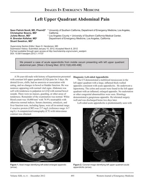 (PDF) Left Upper Quadrant Abdominal Pain