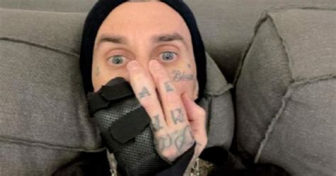 Travis Barker Publica Foto Antes De Su Cirug A Frente A Rumores De