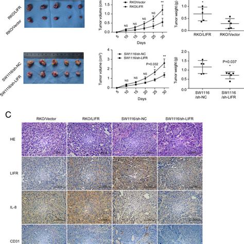 Alteration Of Angiogenesis Related Gene Expression With Lifr Silencing