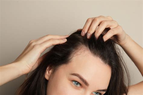 6 Things To Avoid If You Have Thinning Hair Harmony Med Spa