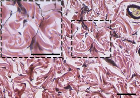 The Proportion Of Type I And Iii Collagen Fibers A Representative