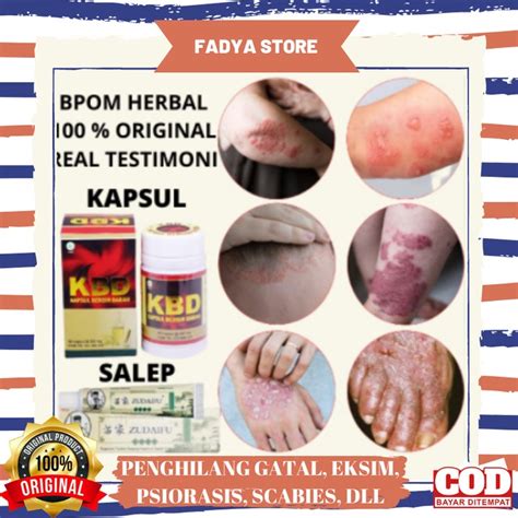 Medicine Pill Ointment Ointment Itchy Itchy Groin Psoriasis Ringworm Shopee Singapore