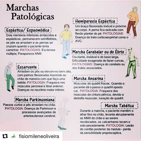 Tipos De Marchas Neurortopedia