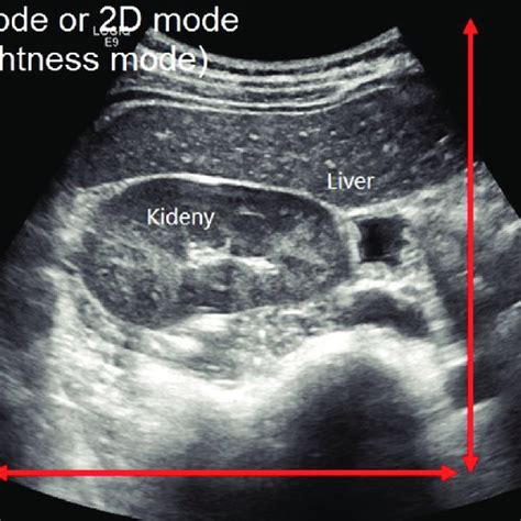 B Mode Of The Ultrasound Download Scientific Diagram