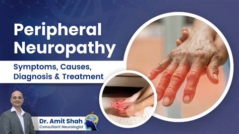 What Is Peripheral Neuropathy Understanding Its Causes Symptoms