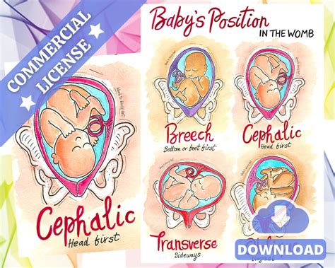 Fetal Baby Womb Positions A3 Printout Download PDF Pregnancy Handout ...