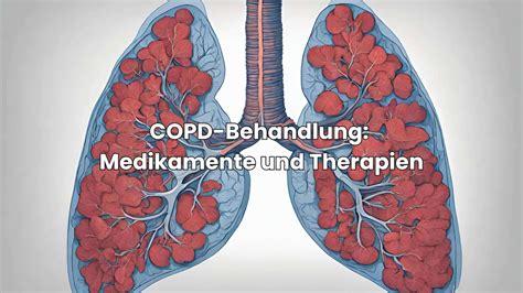 COPD Ursachen Was du über Hauptauslöser wissen solltest