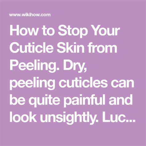 How To Stop Your Cuticle Skin From Peeling Peeling Cuticles Cuticle