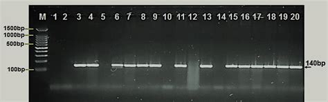 Agarose Gel Electrophoresis Image That Showed Pcr Product Analysis For