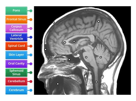 MRI BRAIN LABELLING 1 - Labelled diagram