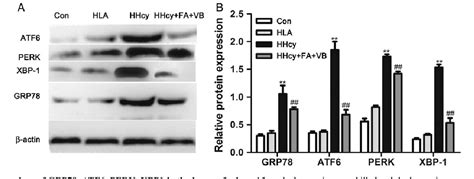 Figure From Endoplasmic Reticulum Oxidoreductin A Mediates Hepatic