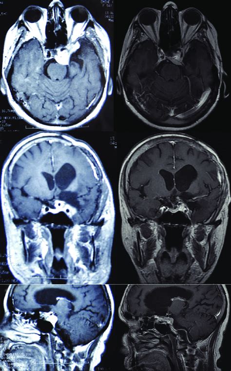 Illustrative Case Of A 54 Year Old Female Patient With Previous Download Scientific Diagram