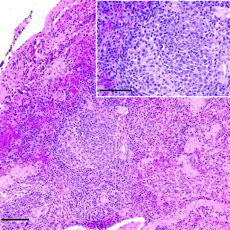 Photomicrographs Of Sections Of The Spleen The White Pulp Has Marked