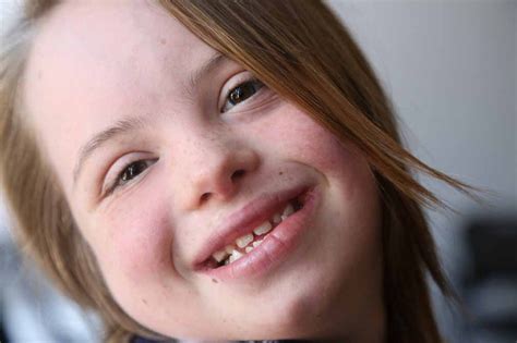 Living With Down Syndrome Positive Exposure