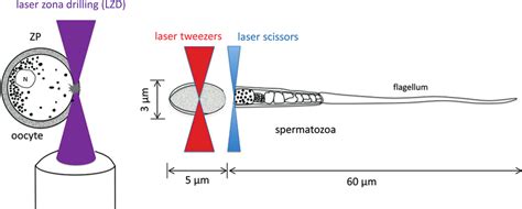 2 Laser Assisted In Vitro Fertilization Bad Quality Sperm Of Low Download Scientific