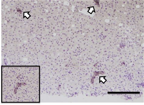 Representative Photographs Of Immunocytochemical Staining Against