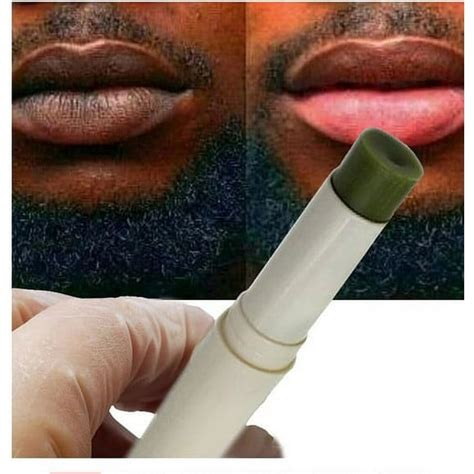 Smokers Lips Lightening Treatment