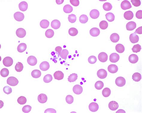 Human Blood Smear With Platelets Photograph By Jose Calvo Science