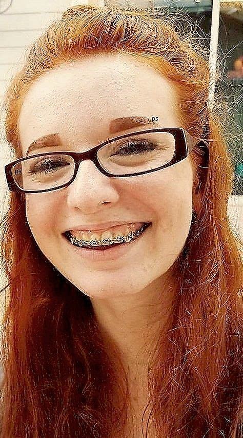 Pin By Gaemma Cherrypop On Female Faces Cute Braces Braces Girls Braces And Glasses