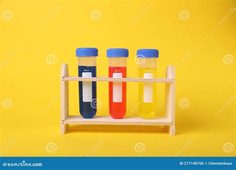 Test Tubes With Colorful Liquids In Wooden Stand On Yellow Background