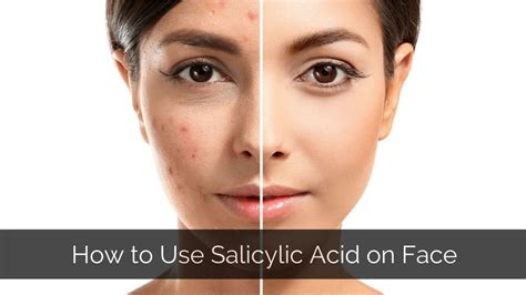 How To Use Salicylic Acid On Face