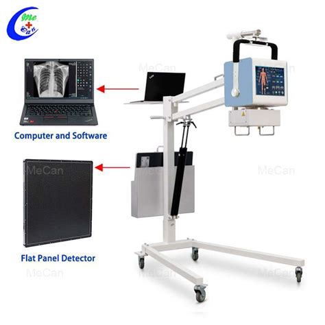 5kw High Frequency Mobile Portable X Ray Machine Portable X Ray