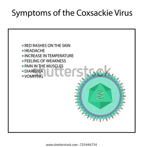 Symptoms Infection Coxsackie Virus Enterovirus Infographics Stock ...