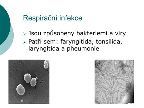 PPT Škodlivé vlivy ovzduší na zdraví člověka PowerPoint Presentation