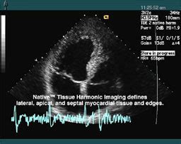 Nondestructive Evaluation Techniques Ultrasound