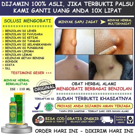 Jual Obat Oles Benjolan Di Payudara Leher Tangan Ketiak Selangkangan