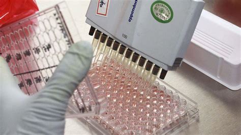 Hiv Treatment Breakthrough Raises Hopes For Cure