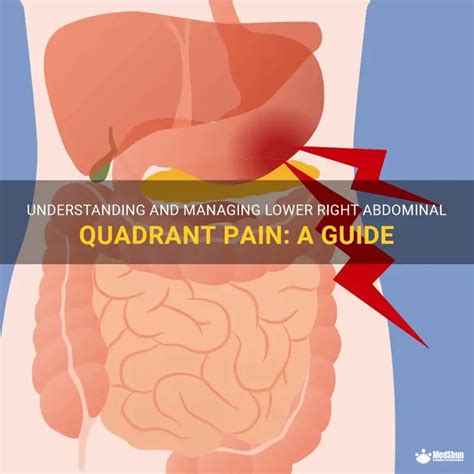understanding  managing   abdominal quadrant pain  guide