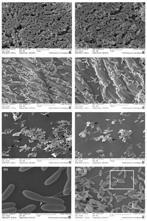 Scanning Electron Microscopy SEM Demonstrating Cell Surface