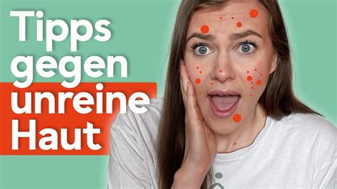 Hautprobleme adé Tipps gegen unreine Haut YouTube