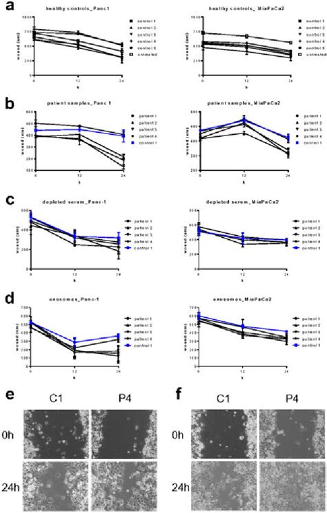 Figure 4 From Quantitative Proteomic Analysis Of Serum Exosomes From