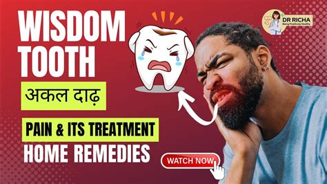 अककल दढ दरद क घरल उपय और इलज Wisdom Tooth Pain Treatment