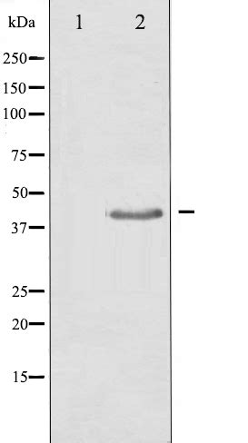 TGF beta 1 Antibody - SAB | Signalway Antibody