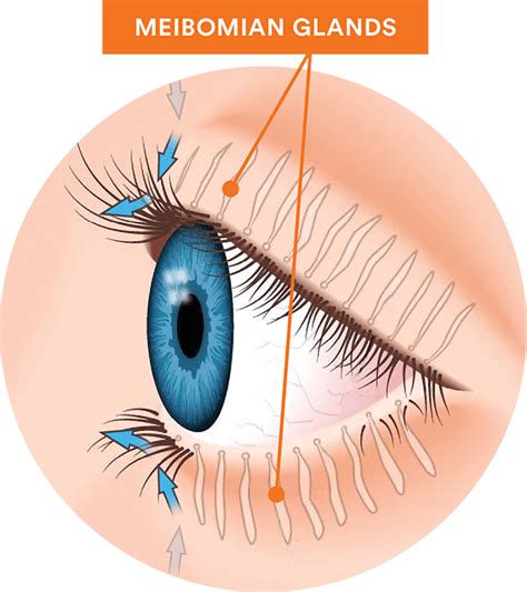 Associated Eye Surgeons - Dry Eye and Meibomian Gland Disfunction