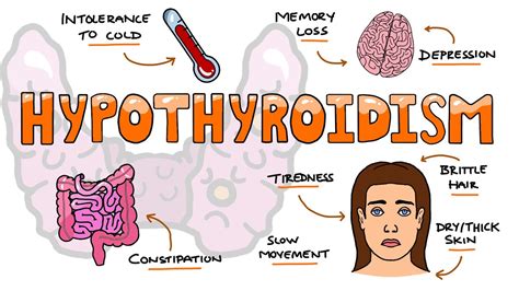 Hypothyroidism Signs And Symptoms Mnemonic Moms So Tired Youtube