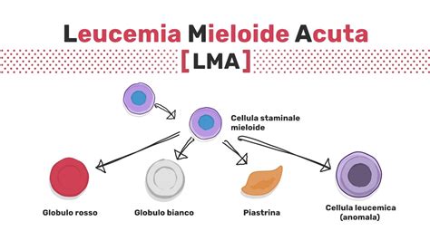 Tipi Di Leucemia Mieloide Acuta Youtube