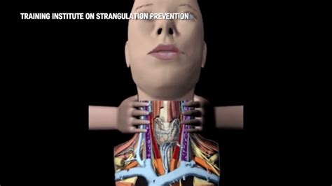 focus     strangulation law impacted  fight